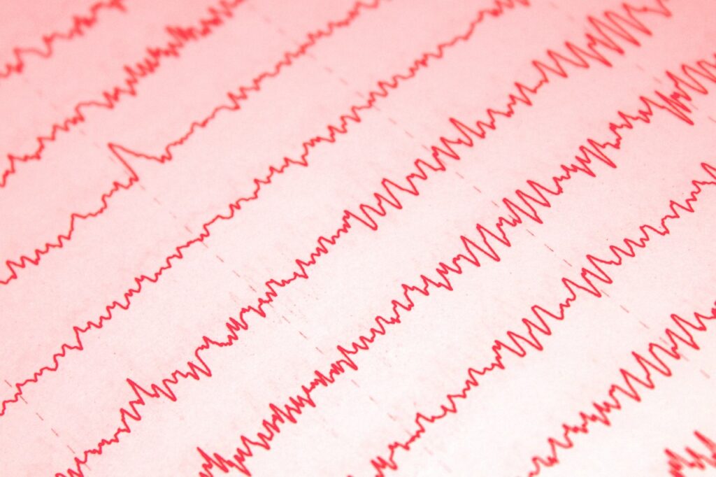 TMS i tDCS – czym się różnią