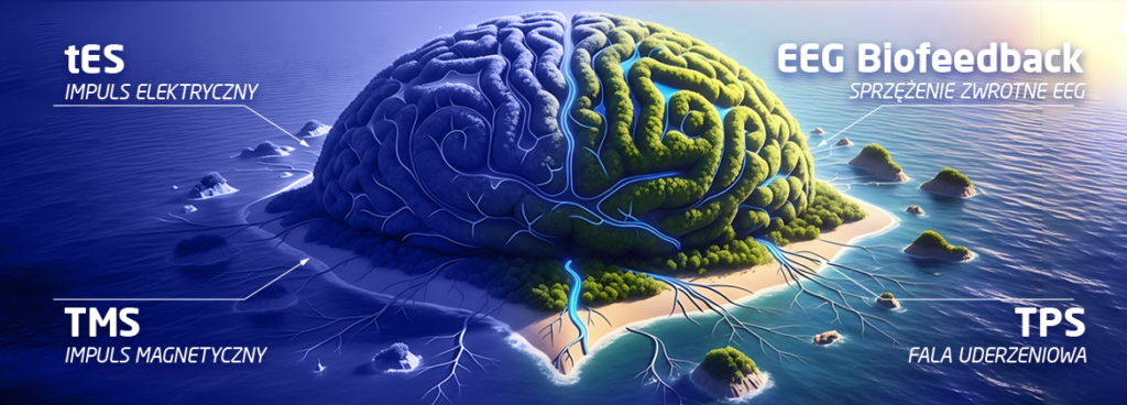 Ilustracja mózgu w formie wyspy z oznaczeniami czterech metod neuromodulacji: tES, TMS, EEG Biofeedback i TPS